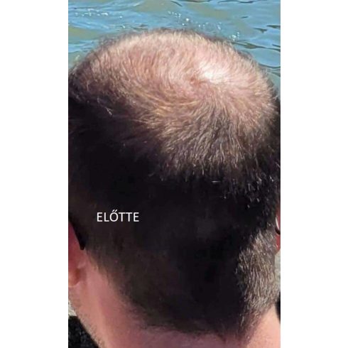 fito.C - Caffeine Anti Hair Loss Revitalizing Tonic for Men - Koffein Hajhullás Elleni Revitalizáló Tonik Férfiaknak, 200ml - 3 hónapra elegendő