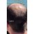 fito.C - Caffeine Anti Hair Loss Revitalizing Tonic for Women - Koffein Hajhullás Elleni Revitalizáló Tonik Nőknek, 20ml - TESZTER